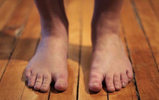 Get Rid of Stinky, Smelly Feet shoes on a rotation