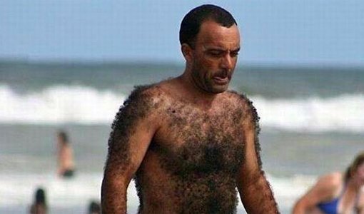 hairybeach