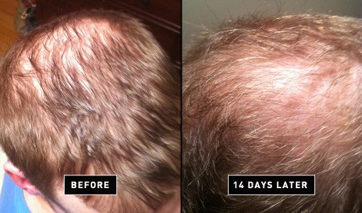 How To Make Thinning Hair Look Thicker For Under $20 - Modern Man