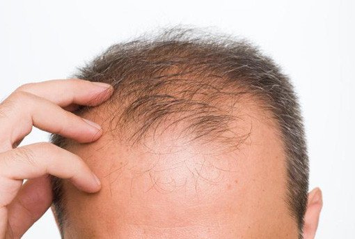 hairstyle tips for guys with thinning hair