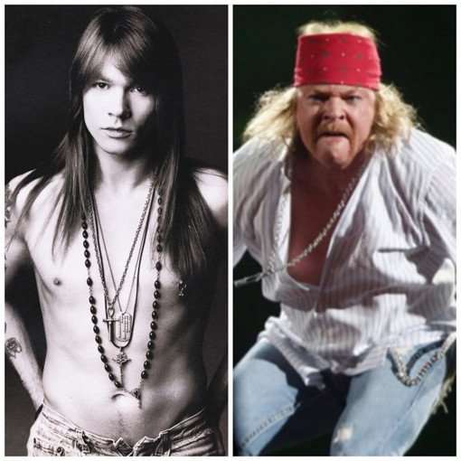 Axl Rose