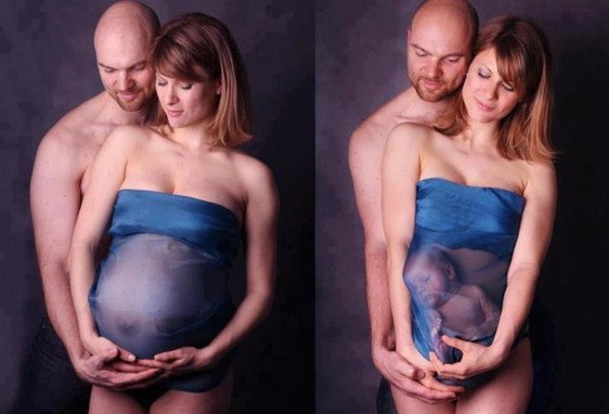 preggo photo fail 7