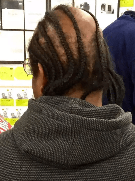 bad combover