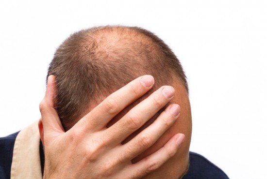 best grooming products for balding men